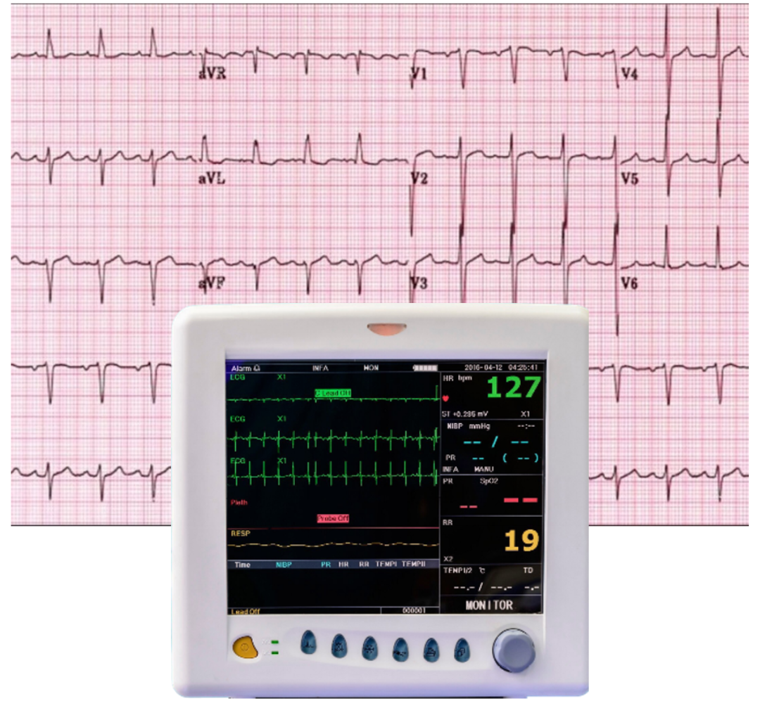 ECG elearning image